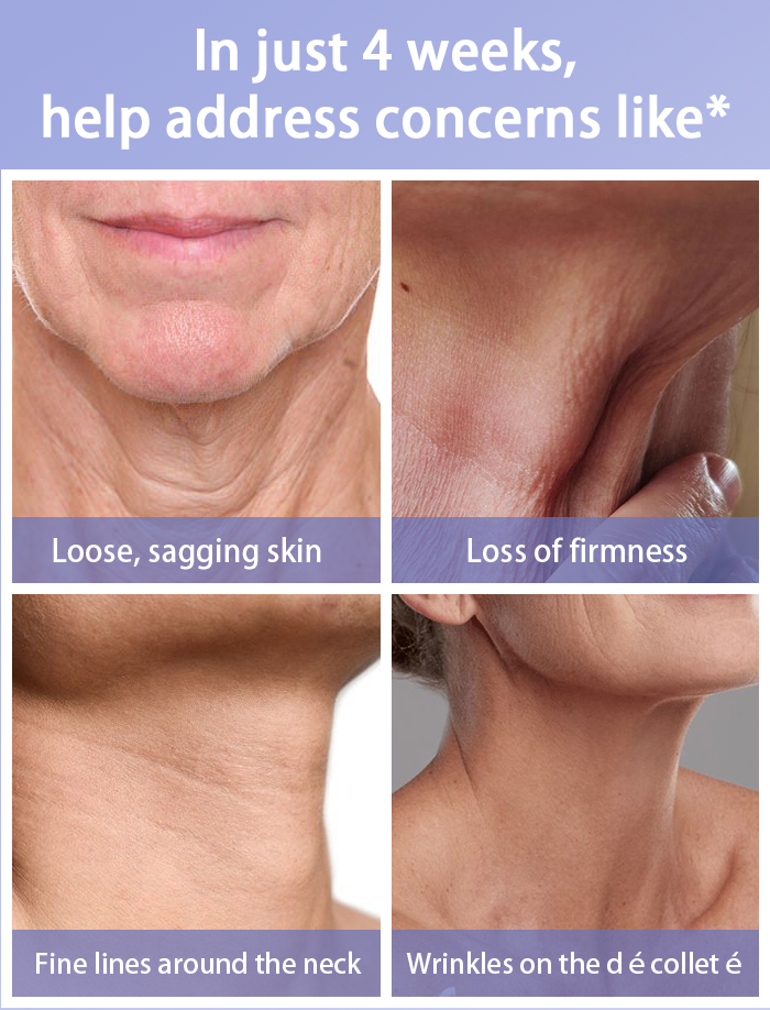 Neck Cream – Firming & Lifting Solution for Crepey Skin